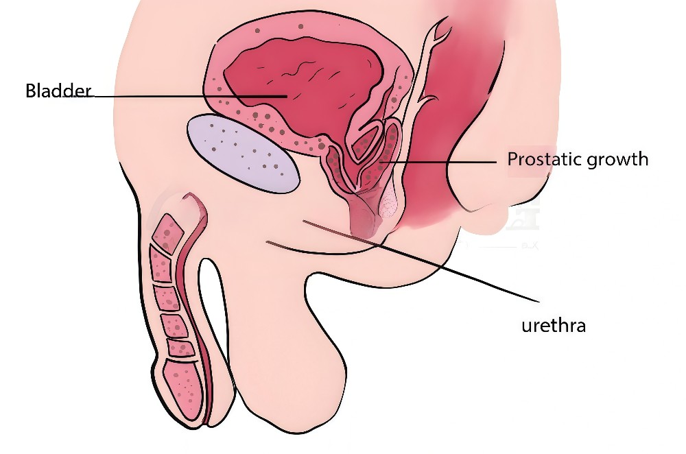 prostate illustration abstract
